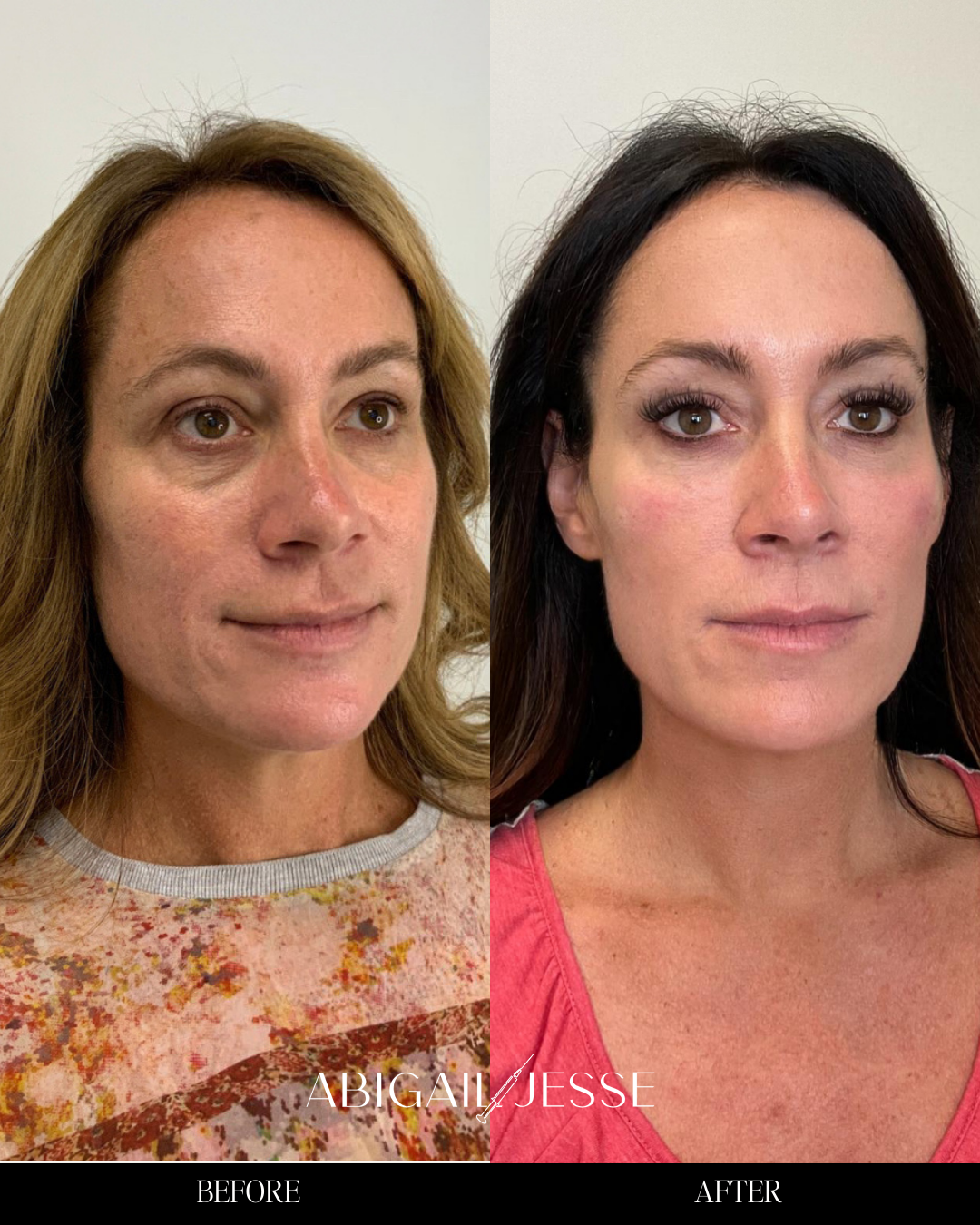 Before and after — portrait results