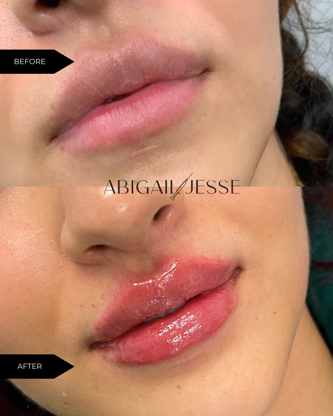 Before and after — treatment results